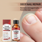🔥Promoção-50% OFF!🔥🖤Veja Resultados Reais Mais Rápido🖤 Essência Reparadora de Unhas para Unhas Danificadas💅🏻