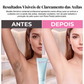 🔥Promoção Quente com 49% de Desconto🔥 Creme Depilatório Suave para Homens e Mulheres – Ação em 5 a 10 Minutos, Calmante, para Peles Sensíveis 🌸