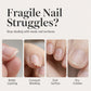 🔥 50% OFF 💅 Garlic Nail Strengthening Polish – Helps Weak, Brittle & Damaged Nails Look Stronger ✨