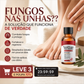 🥳 PROMOÇÃO DE 2026 🥳💞 Mais de 50 mil unidades vendidas! Essência reparadora para unhas danificadas 💅🏻